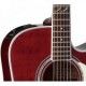 TAKAMINE JOHN JORGENSON body